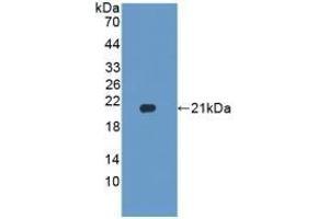 Detection of Recombinant HPA, Rat using Polyclonal Antibody to Heparanase (HPSE) (HPSE antibody  (AA 40-188))