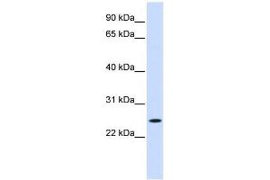 Western Blot showing NOL3 antibody used at a concentration of 1-2 ug/ml to detect its target protein. (NOL3 antibody  (Middle Region))