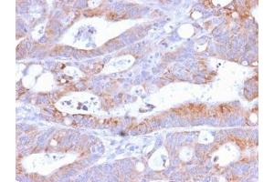 IHC testing of FFPE human colon with recombinant CD86 antibody (C86/2160R). (CD86 antibody)