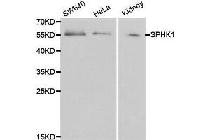 Western blot analysis of extracts of various cell lines, using SPHK1 antibody. (SPHK1 antibody  (AA 50-384))