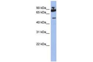 Image no. 1 for anti-IKAROS Family Zinc Finger 1 (Ikaros) (IKZF1) (AA 395-444) antibody (ABIN6742315) (IKZF1 antibody  (AA 395-444))