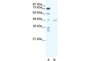 WB Suggested Anti-LDB1 Antibody Titration:  0. (LIM Domain Binding 1 Protein antibody  (Middle Region))