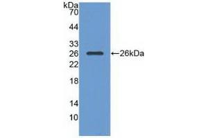 Detection of Recombinant RASA1, Human using Polyclonal Antibody to Ras GTPase Activating Protein 1 (RASA1) (RASA1 antibody  (AA 403-596))