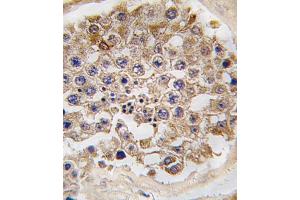 Formalin-fixed and paraffin-embedded human testis tissue reacted with FRp, which was peroxidase-conjugated to the secondary antibody, followed by DAB staining. (MTOR antibody  (AA 2459-2488))