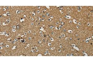 Immunohistochemistry of paraffin-embedded Human brain using NEMF Polyclonal Antibody at dilution of 1:30 (NEMF antibody)