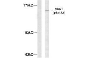 Western blot analysis of extracts from MDA-MB-435 cells treated with TNF-alpha, using ASK1 (Phospho-Ser83) Antibody. (ASK1 antibody  (pSer83))