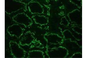 Immunohistochemistry on frozen section of human kidney positive reactivity in renal tubules epithelium (CDH6 antibody)