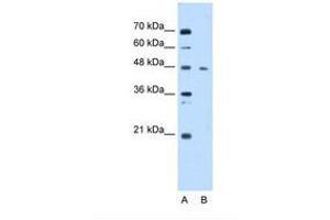 Image no. 1 for anti-Enolase 3 (Beta, Muscle) (ENO3) (AA 21-70) antibody (ABIN6738428) (ENO3 antibody  (AA 21-70))