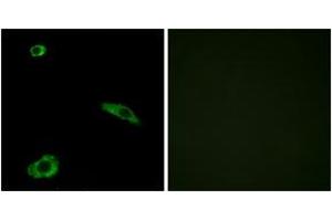 Immunofluorescence analysis of MCF7 cells, using ACTHR Antibody. (MC2R antibody  (AA 248-297))
