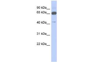 WB Suggested Anti-ZNF446 Antibody Titration:  0. (ZNF446 antibody  (N-Term))