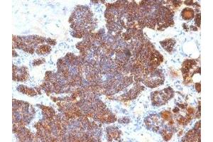 Formalin-fixed, paraffin-embedded human parathyroid stained with PTH antibody (PTH/1174). (PTH antibody  (AA 32-115))