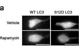 Something like SH-SY5Y cells expressing GFP-LC3-WT or-S12D treated with rapamycin or vehicle for 1h. (MAP1LC3A antibody  (N-Term, pSer12))