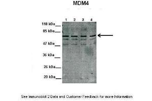 Lanes:  1. (MDM4-binding Protein antibody  (N-Term))