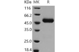 CNTF Receptor alpha Protein (His tag)