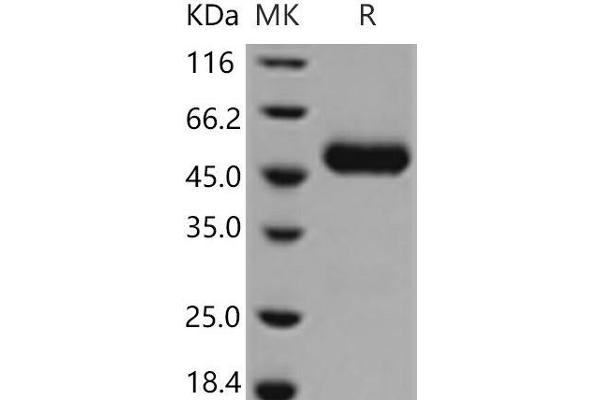 CNTF Receptor alpha Protein (His tag)