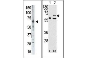 Image no. 1 for anti-Matrix Metallopeptidase 14 (Membrane-inserted) (MMP14) (N-Term) antibody (ABIN358687) (MMP14 antibody  (N-Term))