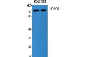 Western Blot (WB) analysis of specific cells using HDAC5 Polyclonal Antibody. (HDAC5 antibody  (Tyr512))