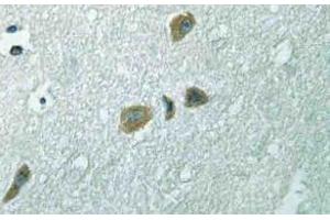 Immunohistochemistry (IHC) analyzes of ILK antibody in paraffin-embedded human brain tissue. (ILK antibody)