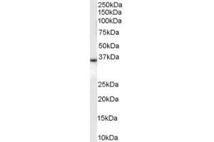 Western Blotting (WB) image for anti-BRCA1 Associated RING Domain 1 (BARD1) (C-Term) antibody (ABIN2156425) (BARD1 antibody  (C-Term))