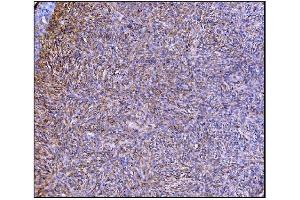 IHC analysis of Prolyl Endopeptidase/PREP using anti-Prolyl Endopeptidase/PREP antibody (ABIN7599118).