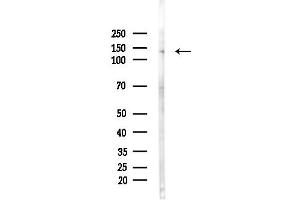anti-SR-Related CTD-Associated Factor 4 (SCAF4) (C-Term) antibody