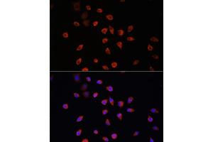 Immunofluorescence analysis of L929 cells using IFT88 antibody (ABIN6131798, ABIN6142226, ABIN6142227 and ABIN6216899) at dilution of 1:100. (IFT88 antibody  (AA 534-833))