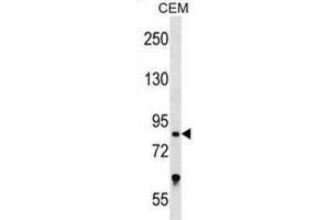 Western Blotting (WB) image for anti-Transcription Factor 25 (Basic Helix-Loop-Helix) (TCF25) antibody (ABIN2999343) (TCF25 antibody)