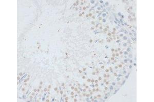 Immunohistochemistry of paraffin-embedded Rat testis using DNMT3B Polyclonal Antibody at dilution of 1:100 (40x lens). (DNMT3B antibody)