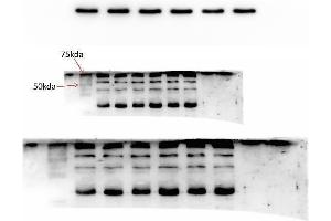 anti-G Protein-Coupled Receptor Kinase 5 (GRK5) (AA 393-429), (C-Term) antibody