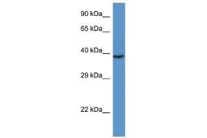 Western Blot showing RAD51L3 antibody used at a concentration of 1 ug/ml against Fetal Heart Lysate (RAD51D antibody  (C-Term))