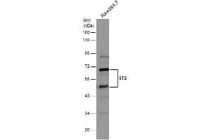 WB Image Whole cell extract (30 μg) was separated by 10% SDS-PAGE, and the membrane was blotted with ST2 antibody [N1C1] , diluted at 1:500. (IL1RL1 antibody)