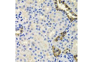 Immunohistochemistry of paraffin-embedded mouse kidney using CALB2 antibody (ABIN6003539) at dilution of 1/100 (40x lens). (Calretinin antibody)