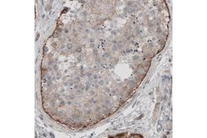 Immunohistochemical staining (Formalin-fixed paraffin-embedded sections) of human testis with LAMA1 monoclonal antibody, clone CL3087  shows moderate immunoreactivity in basement membrane of seminiferous tubules.
