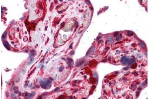 Human Placenta: Formalin-Fixed, Paraffin-Embedded (FFPE) (Stathmin 1 antibody  (AA 85-119))