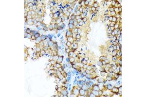 Immunohistochemistry of paraffin-embedded mouse testis using STIP1 Rabbit mAb (ABIN1512566, ABIN3020619, ABIN3020620 and ABIN7101303) at dilution of 1:100 (40x lens). (STIP1 antibody)