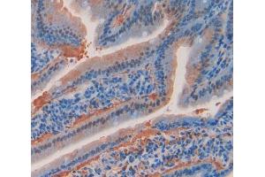 Used in DAB staining on fromalin fixed paraffin- embedded Kidney tissue (Angiopoietin 4 antibody  (AA 272-489))