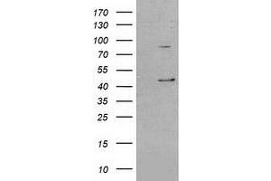 SERPINB3 antibody