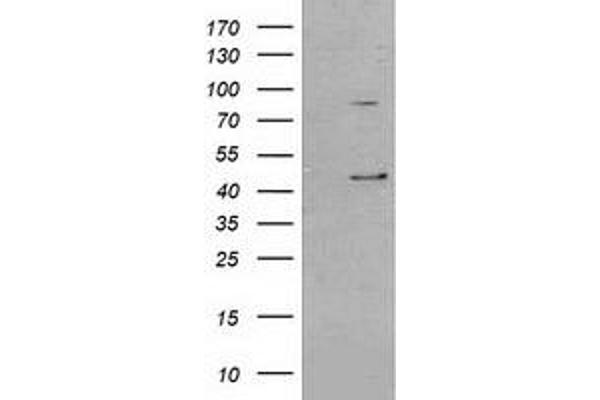 SERPINB3 antibody