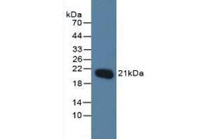 Detection of MGMT in Human Jurkat Cells using Polyclonal Antibody to O-6-Methylguanine DNA Methyltransferase (MGMT) (MGMT antibody  (AA 1-207))