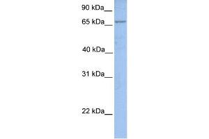 WB Suggested Anti-ACSL1 Antibody Titration:  0. (ACSL1 antibody  (N-Term))
