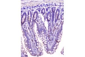 IHC analysis of RASAL1 using anti-RASAL1 antibody (ABIN6719367). (RASAL1 antibody  (AA 721-798))