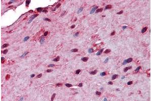 Human Small Intestine, Muscularis Propria: Formalin-Fixed, Paraffin-Embedded (FFPE) (STIP1 antibody  (AA 1-544))