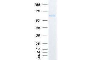 Western Blotting (WB) image for Phosphatidylinositol-4-Phosphate 5-Kinase, Type I, gamma (PIP5K1C) protein (Myc-DYKDDDDK Tag) (ABIN2729010)