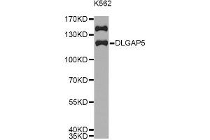 Western blot analysis of extracts of K562 cells, using DLGAP5 antibody (ABIN5971223) at 1/1000 dilution.
