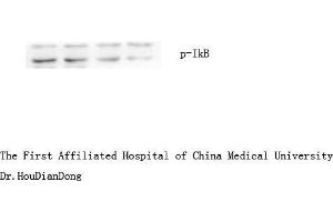 Western Blotting (WB) image for anti-Nuclear Factor of kappa Light Polypeptide Gene Enhancer in B-Cells Inhibitor, alpha (NFKBIA) (pSer32), (pSer36) antibody (ABIN6280557)