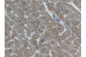 Detection of cTnI in Porcine Heart Tissue using Polyclonal Antibody to Cardiac Troponin I (cTnI) (TNNI3 antibody  (AA 2-211))