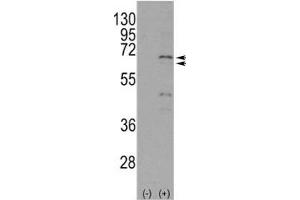 Western blot analysis of NUR77 antibody and 293 cell lysate either nontransfected (Lane 1) or transiently transfected with the NR4A1 gene (2). (NR4A1 antibody  (AA 329-358))