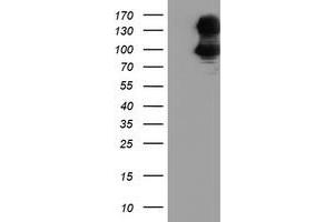 HEK293T cells were transfected with the pCMV6-ENTRY control (Left lane) or pCMV6-ENTRY DPP9 (Right lane) cDNA for 48 hrs and lysed. (DPP9 antibody)