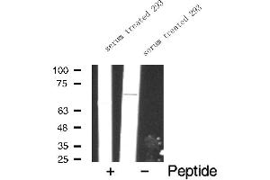 Western blot analysis of FKHR expression in serum treated 293 whole cell lysates,The lane on the left is treated with the antigen-specific peptide. (FOXO1 antibody  (Internal Region))