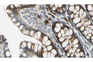 ABIN6272259 at 1/100 staining Rat colon tissue by IHC-P.